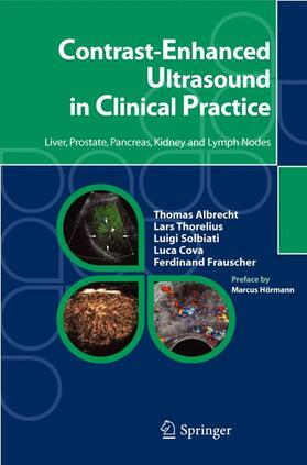 Albrecht / Thorelius / Solbiati |  Contrast-Enhanced Ultrasound in Clinical Practice | Buch |  Sack Fachmedien