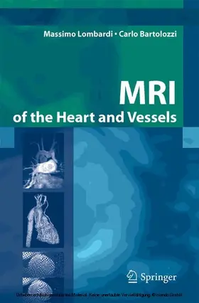 Lombardi / Bartolozzi |  MRI of the Heart and Vessels | eBook | Sack Fachmedien