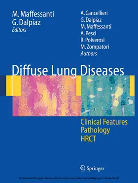 Maffessanti / Dalpiaz | Diffuse Lung Diseases | E-Book | sack.de