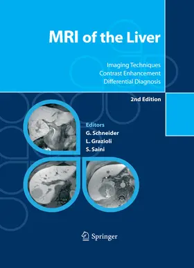Schneider / Grazioli / Saini |  MRI of the Liver | eBook | Sack Fachmedien