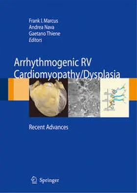 Marcus / Thiene / Nava |  Arrhythmogenic RV Cardiomyopathy/Dysplasia | Buch |  Sack Fachmedien