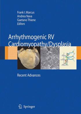 Marcus / Nava / Thiene |  Arrhythmogenic RV Cardiomyopathy/Dysplasia | eBook | Sack Fachmedien