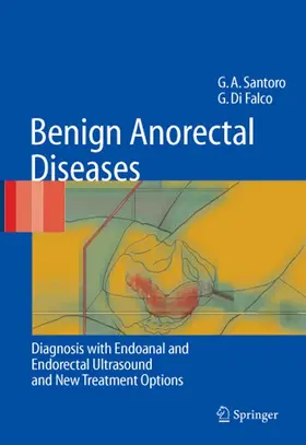 Santoro / Di Falco | Benign Anorectal Diseases | E-Book | www.sack.de
