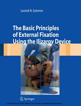Solomin |  The Basic Principles of External Skeletal Fixation Using the Ilizarov Device | eBook | Sack Fachmedien