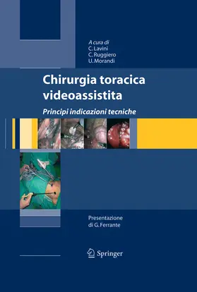Lavini / Ruggiero / Morandi |  Chirurgia toracica videoassistita | eBook | Sack Fachmedien
