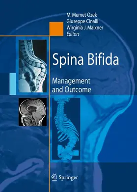 Özek / Maixner / Cinalli |  Spina Bifida | Buch |  Sack Fachmedien
