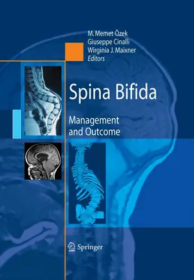Özek / Cinalli / Maixner |  Spina Bifida | eBook | Sack Fachmedien