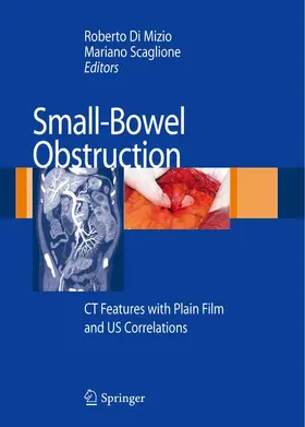 Di Mizio / Scaglione | Small-Bowel Obstruction | Buch | 978-88-470-0666-9 | www.sack.de