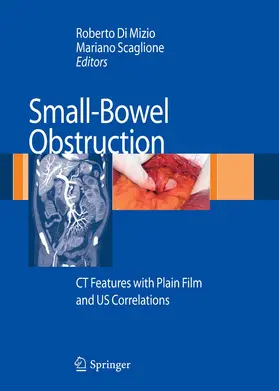 Scaglione | Small-Bowel Obstruction | E-Book | www.sack.de