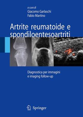 Garlaschi / Martino |  Artrite Reumatoide E Spondiloentesoartriti | Buch |  Sack Fachmedien