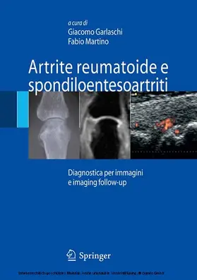 Garlaschi / Martino | Artrite reumatoide e spondiloentesoartriti | E-Book | www.sack.de