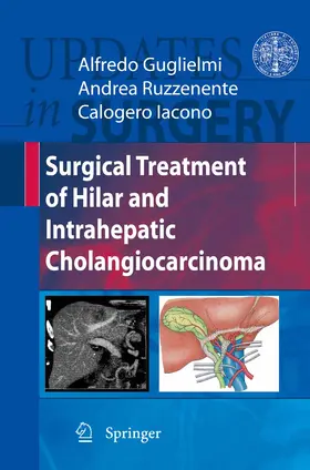Guglielmi / Ruzzenente / Iacono | Surgical Treatment of Hilar and Intrahepatic Cholangiocarcinoma | E-Book | www.sack.de