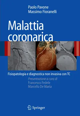 Pavone / Fioranelli |  Malattia coronarica | eBook | Sack Fachmedien