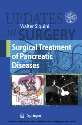 Siquini |  Surgical Treatment of Pancreatic Diseases | eBook | Sack Fachmedien