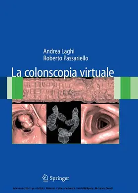 Laghi / Passariello | La colonscopia virtuale | E-Book | sack.de