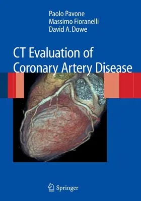 Pavone / Fioranelli |  CT Evaluation of Coronary Artery Disease | eBook | Sack Fachmedien