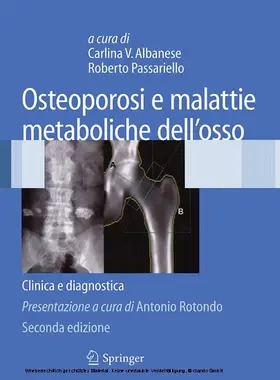 Albanese / Passariello |  Osteoporosi e malattie metaboliche dell'osso | eBook | Sack Fachmedien