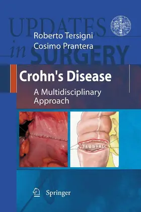 Tersigni / Prantera |  Crohn's Disease | eBook | Sack Fachmedien