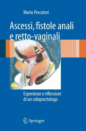 Pescatori |  Ascessi, fistole anali e retto-vaginali | eBook | Sack Fachmedien