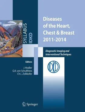 Hodler / Schulthess / Zollikofer | Diseases of the Heart, Chest & Breast 2011-2014 | E-Book | www.sack.de