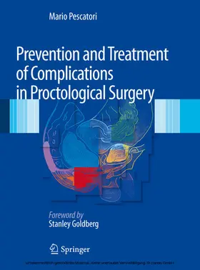 Pescatori |  Prevention and Treatment of Complications in Proctological Surgery | eBook | Sack Fachmedien