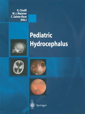Cinalli / Maixner / Sainte-Rose |  Pediatric Hydrocephalus | eBook | Sack Fachmedien