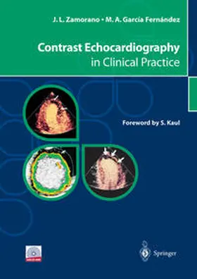 Zamorano / García Fernández |  Contrast Echocardiography in Clinical Practice | eBook | Sack Fachmedien