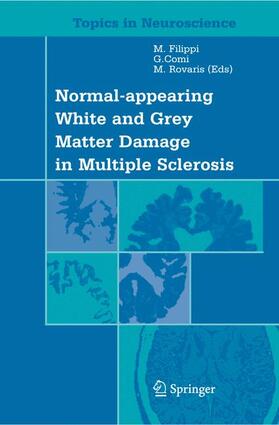 Filippi / Rovaris / Comi | Normal-appearing White and Grey Matter Damage in Multiple Sclerosis | Buch | 978-88-470-2175-4 | sack.de