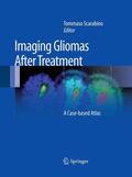 Scarabino |  Imaging Gliomas After Treatment | eBook | Sack Fachmedien