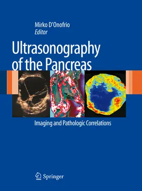 D'Onofrio |  Ultrasonography of the Pancreas | eBook | Sack Fachmedien