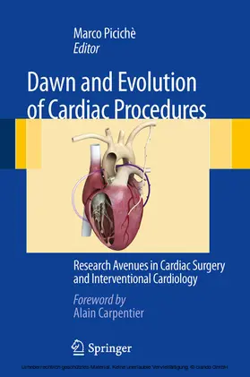 Picichè | Dawn and Evolution of Cardiac Procedures | E-Book | www.sack.de
