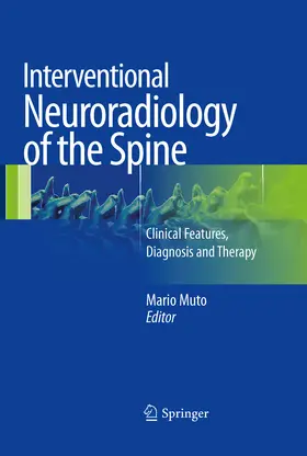 Muto |  Interventional Neuroradiology of the Spine | eBook | Sack Fachmedien