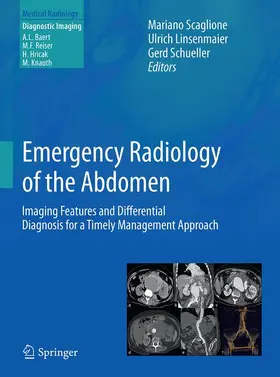 Scaglione / Linsenmaier / Schueller |  Emergency Radiology of the Abdomen | Buch |  Sack Fachmedien