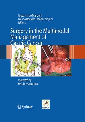 De Manzoni / Siquini / Roviello |  Surgery in the Multimodal Management of Gastric Cancer | Buch |  Sack Fachmedien