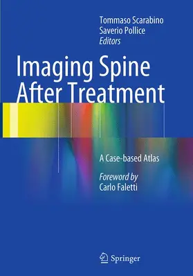 Scarabino / Pollice |  Imaging Spine After Treatment | Buch |  Sack Fachmedien