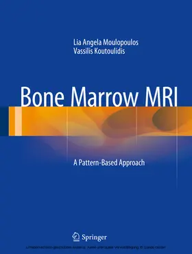 Moulopoulos / Koutoulidis |  Bone Marrow MRI | eBook | Sack Fachmedien