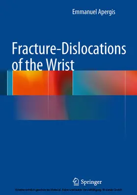 Apergis |  Fracture-Dislocations of the Wrist | eBook | Sack Fachmedien