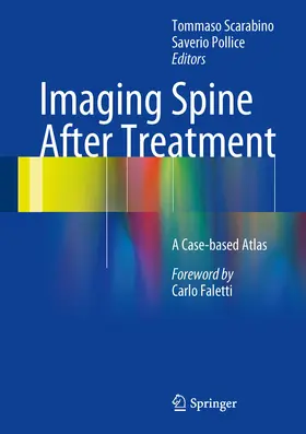 Scarabino / Pollice |  Imaging Spine After Treatment | eBook | Sack Fachmedien