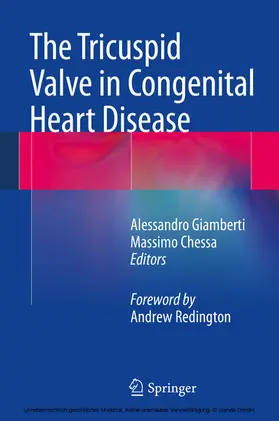 Giamberti / Chessa | The Tricuspid Valve in Congenital Heart Disease | E-Book | www.sack.de