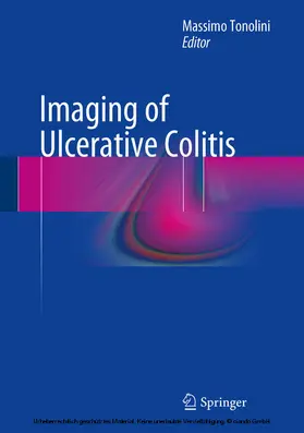 Tonolini |  Imaging of Ulcerative Colitis | eBook | Sack Fachmedien