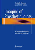 Albanese / Faletti |  Imaging of Prosthetic Joints | eBook | Sack Fachmedien