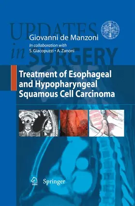 De Manzoni |  Treatment of Esophageal and Hypopharyngeal Squamous Cell Carcinoma | Buch |  Sack Fachmedien