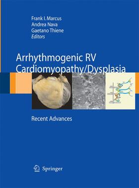 Marcus / Thiene / Nava |  Arrhythmogenic RV Cardiomyopathy/Dysplasia | Buch |  Sack Fachmedien