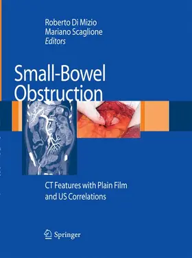 Di Mizio / Scaglione | Small-Bowel Obstruction | Buch | 978-88-470-5622-0 | www.sack.de