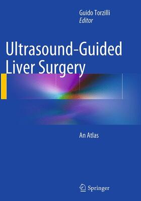 Torzilli |  Ultrasound-Guided Liver Surgery | Buch |  Sack Fachmedien