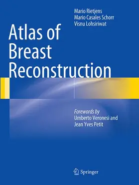 Rietjens / Lohsiriwat / Casales Schorr |  Atlas of Breast Reconstruction | Buch |  Sack Fachmedien