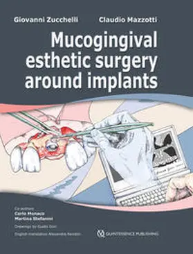 Zucchelli / Mazzotti |  Mucogingival Esthetic Surgery around Implants | Buch |  Sack Fachmedien