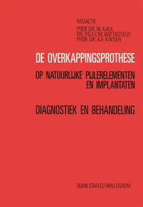 Kalk |  De overkappingsprothese | Buch |  Sack Fachmedien