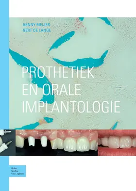 Meijer / de Lange |  Prothetiek En Orale Implantologie | Buch |  Sack Fachmedien