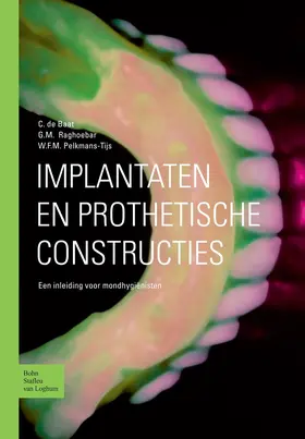 de Baat / Pelkmans-Tijs / Raghoebar |  Implantaten en prothetische constructies | Buch |  Sack Fachmedien